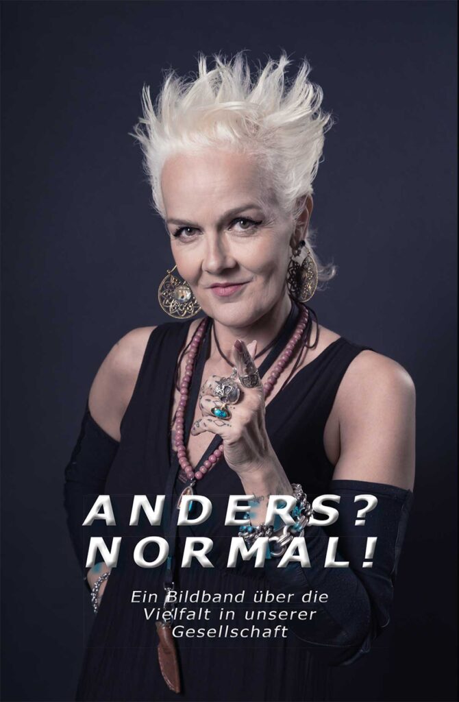 ANDERS? NORMAL!